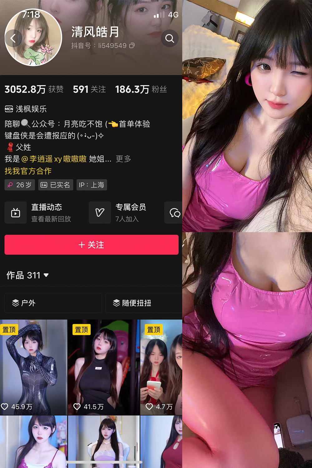 图片[1]-抖音 清风皓月 微密圈  NO.003期 【18P6V】最新至：2025.5.25 - 微觅圈-微觅圈