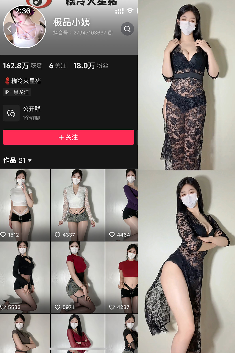 图片[1]-抖音 极品小姨 微密圈  NO.023期 【5V】最新至：2025.5.26 - 微觅圈-微觅圈